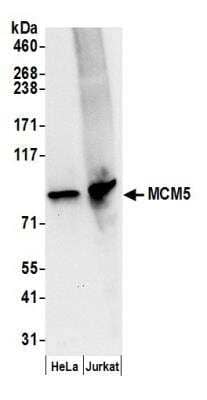 Western Blot: MCM5 Antibody [NB100-79778]