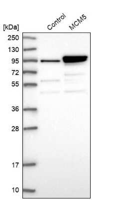 Western Blot: MCM5 Antibody [NBP1-85722]