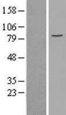 Western Blot: MCM5 Overexpression Lysate [NBL1-12954]