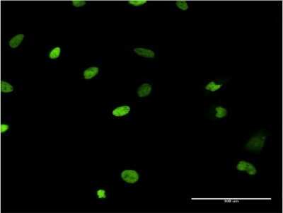 Immunocytochemistry/ Immunofluorescence: MCM6 Antibody (7D8) [H00004175-M04]