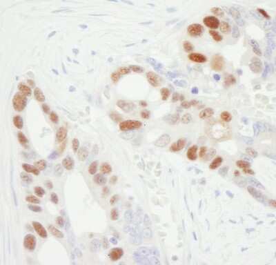 Immunohistochemistry: MCM6 Antibody [NB100-251]