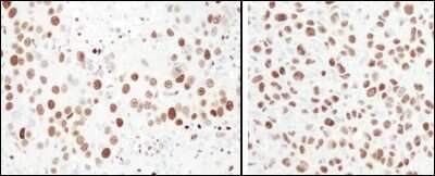 Immunohistochemistry-Paraffin: MCM6 Antibody [NB100-291]