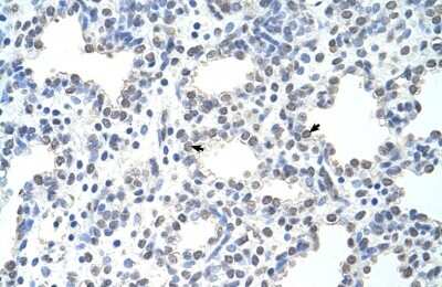 Immunohistochemistry-Paraffin: MCM6 Antibody [NBP1-58075]