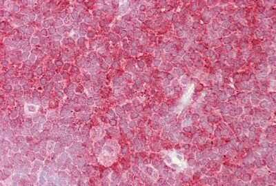 Immunohistochemistry-Paraffin: MCM6 Antibody [NBP1-58075]