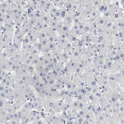 Immunohistochemistry-Paraffin: MCM6 Antibody [NBP1-82642]