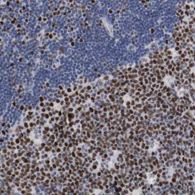 Immunohistochemistry-Paraffin: MCM6 Antibody [NBP1-82642]