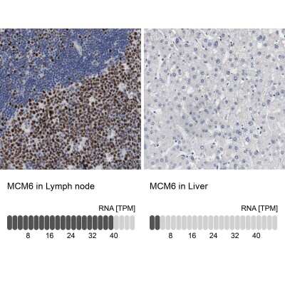 Immunohistochemistry-Paraffin: MCM6 Antibody [NBP1-82642]