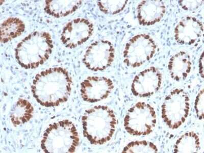 Immunohistochemistry-Paraffin: MCM6 Antibody (MCM6/2999) - Azide and BSA Free [NBP2-79862]