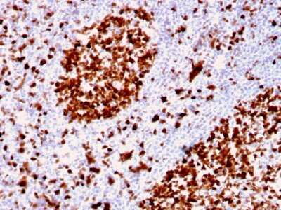Immunohistochemistry-Paraffin: MCM6 Antibody (MCM6/2999) [NBP2-79727]