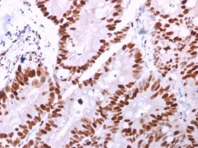 Immunohistochemistry-Paraffin: MCM6 Antibody (MCM6/2999) [NBP2-79727]