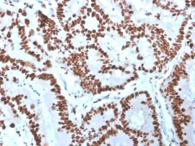 Immunohistochemistry-Paraffin: MCM6 Antibody (MCM6/3000) - Azide and BSA Free [NBP2-79863]