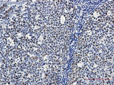 Immunohistochemistry-Paraffin: MCM6 Antibody (S02-2I2) [NBP3-19486]