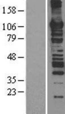 Western Blot: MCM6 Overexpression Lysate [NBL1-12955]