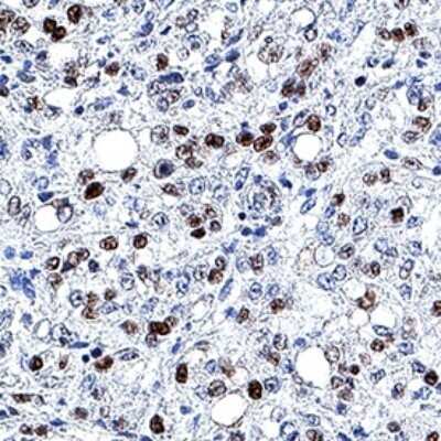 Immunohistochemistry: MCM7 Antibody (2068C) - Azide and BSA Free [MAB92171]
