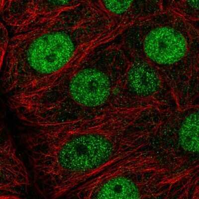 Immunocytochemistry/ Immunofluorescence: MCM7 Antibody [NBP1-85721]