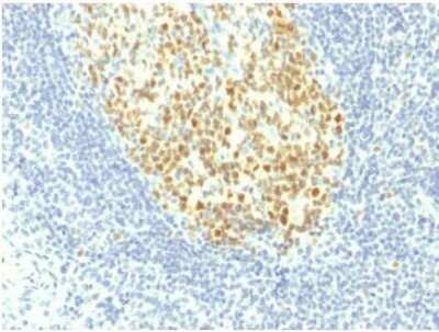 Immunohistochemistry-Paraffin: MCM7 Antibody (MCM7/1467) - Azide and BSA Free [NBP2-59609]