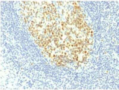 Immunohistochemistry-Paraffin: MCM7 Antibody (MCM7/1467) [NBP2-59608]