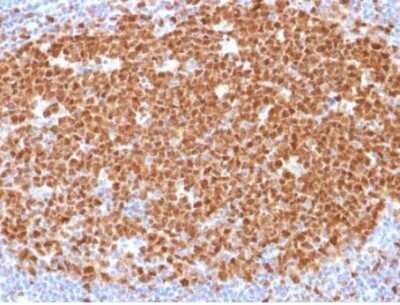 Immunohistochemistry-Paraffin: MCM7 Antibody (MCM7/1468) - Azide and BSA Free [NBP2-59611]