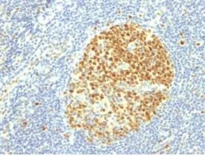 Immunohistochemistry-Paraffin: MCM7 Antibody (MCM7/1469) - Azide and BSA Free [NBP2-59614]