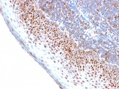 Immunohistochemistry-Paraffin: MCM7 Antibody (MCM7/2756R) - Azide and BSA Free [NBP3-08404]