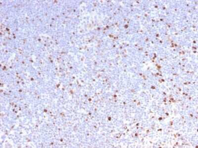 Immunohistochemistry-Paraffin: MCM7 Antibody (MCM7/2832R) [NBP3-07284]