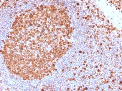 Immunohistochemistry-Paraffin: MCM7 Antibody (MCM7/2832R) [NBP3-07284]