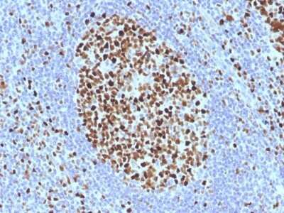Immunohistochemistry-Paraffin: MCM7 Antibody (SPM379) - Azide and BSA Free [NBP2-54460]