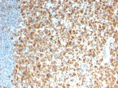 Immunohistochemistry-Paraffin: MCM7 Antibody (rMCM7/1468) [NBP3-07277]