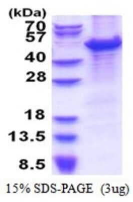 SDS-PAGE: Recombinant Human MCM7 His Protein [NBP2-51540]