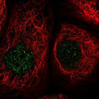 Immunocytochemistry/ Immunofluorescence: MCM8 Antibody [NBP2-55276]