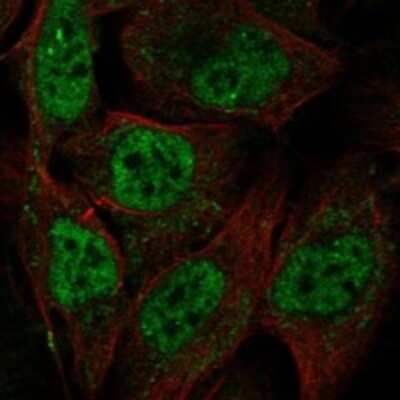 Immunocytochemistry/ Immunofluorescence: MCM8 Antibody [NBP3-17736]