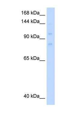 Western Blot: MCM8 Antibody [NBP1-58129]