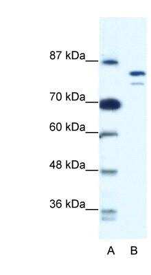 Western Blot: MCM8 Antibody [NBP1-58130]