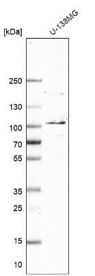 Western Blot: MCM8 Antibody [NBP2-55276]