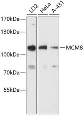 Western Blot: MCM8 AntibodyAzide and BSA Free [NBP3-05116]