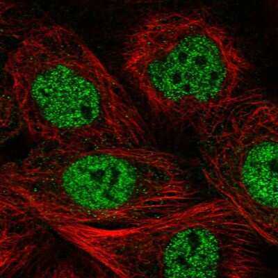 Immunocytochemistry/ Immunofluorescence: MCM9 Antibody [NBP1-86740]