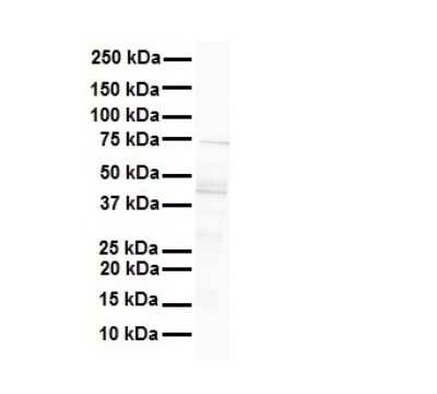 Western Blot: MCM9 Antibody [NBP1-58128]