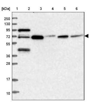 Western Blot: MCMBP Antibody [NBP1-90746]