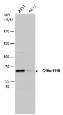 Western Blot: MCMBP Antibody [NBP2-43603]