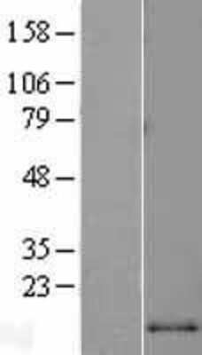 Western Blot: CCL2/MCP1 Overexpression Lysate [NBL1-08849]