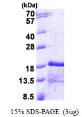 SDS-PAGE: Recombinant Mouse CCL2/MCP1 His Protein [NBP2-22772]