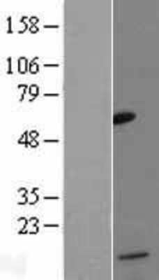 Western Blot: CCL13/MCP-4 Overexpression Lysate [NBL1-08843]