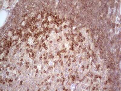 Immunohistochemistry: MCPH1 Antibody (OTI2A3) [NBP2-45775]