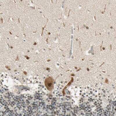 Immunohistochemistry-Paraffin: MCPH1 Antibody [NBP1-89937]