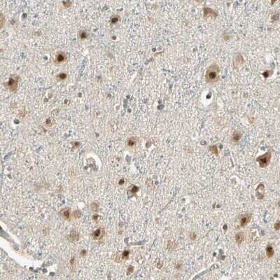 Immunohistochemistry-Paraffin: MCPH1 Antibody [NBP1-89937]