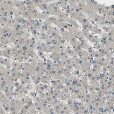 Immunohistochemistry-Paraffin: MCPH1 Antibody [NBP1-89937]