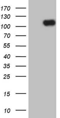 Western Blot: MCPH1 Antibody (OTI2A3)Azide and BSA Free [NBP2-72600]