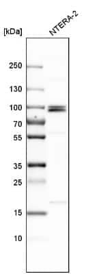 Western Blot: MCPH1 Antibody [NBP1-89937]