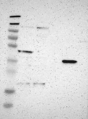 Western Blot: MCPH1 Antibody [NBP3-17888]