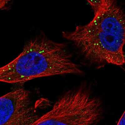 Immunocytochemistry/ Immunofluorescence: MCPIP1/ZC3H12A Antibody [NBP2-37871]